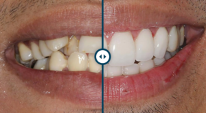 Cosmetic Dentistry