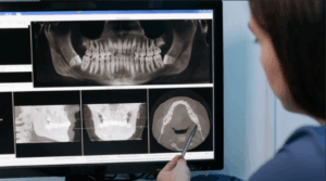 Dentist examines x-rays of wisdom teeth