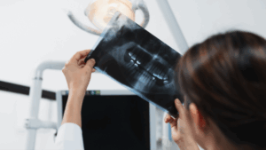 Dentist inspecting an x-ray of a patient’s teeth